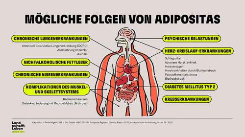 Infografik: M�gliche Folgen von Adipositas